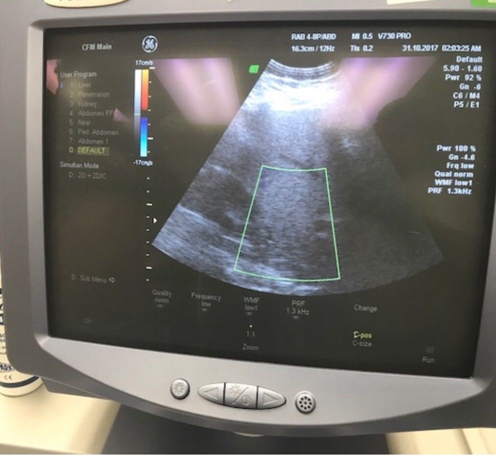 close up of monitor