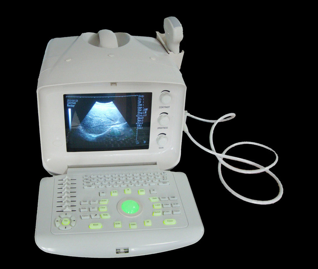Full Digital Ultrasound Scanner/Machine Convex/Transvaginal 2 Probe USB Port 3D 190891466129 DIAGNOSTIC ULTRASOUND MACHINES FOR SALE