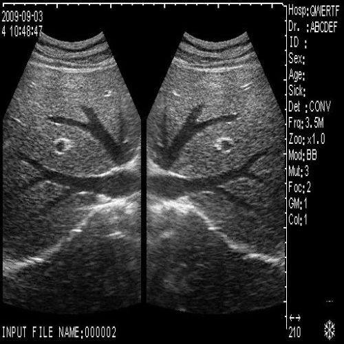 Diagnostic Ultrasound Scanner Machine Convex+Transvaginal 2 Probe 3D Workstation 190891280077 DIAGNOSTIC ULTRASOUND MACHINES FOR SALE