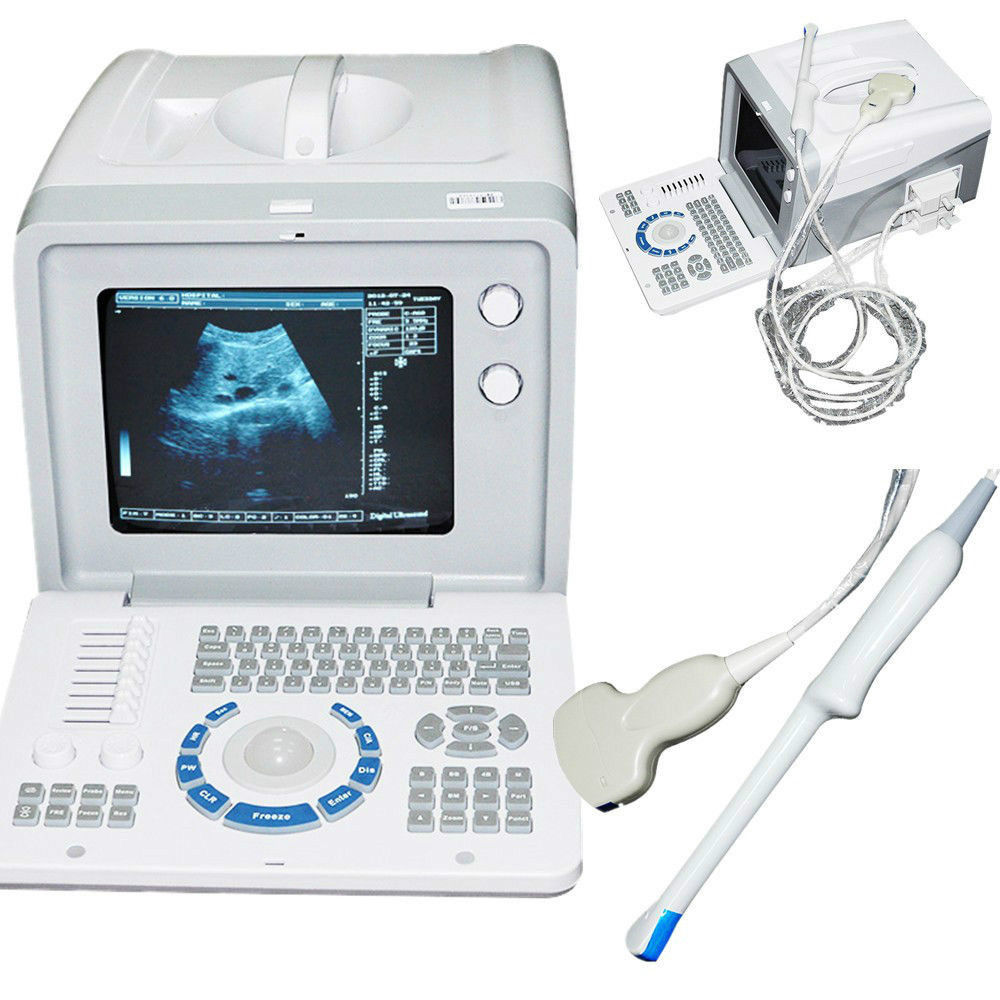 Full Digital 3D Portable Ultrasound Scanner Machine Convex +Transvaginal Probe  190891942043 DIAGNOSTIC ULTRASOUND MACHINES FOR SALE