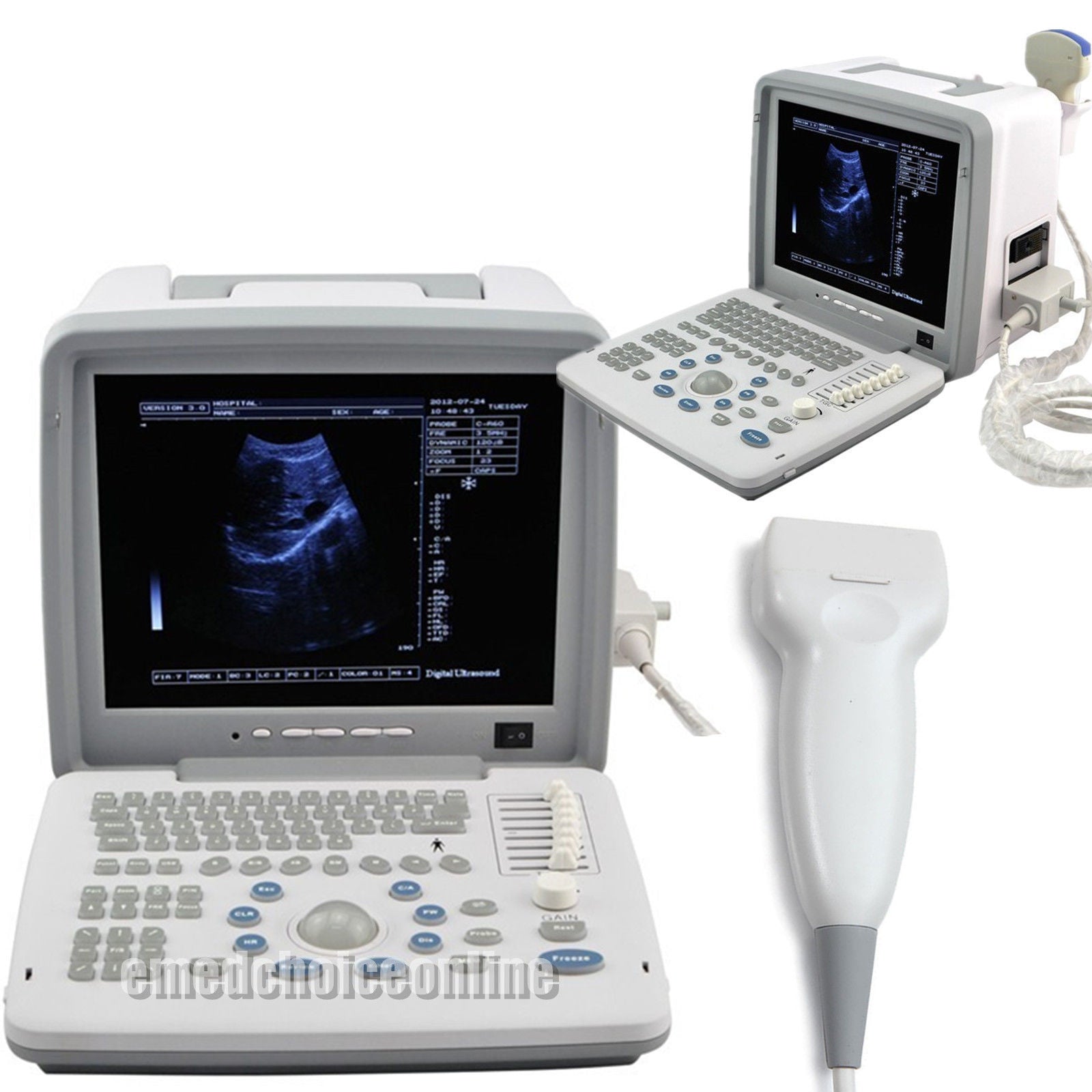 Portable Ultrasound Scanner/Machine +7.5MHz Linear Probe/Transducer Free 3D  190891434975 DIAGNOSTIC ULTRASOUND MACHINES FOR SALE