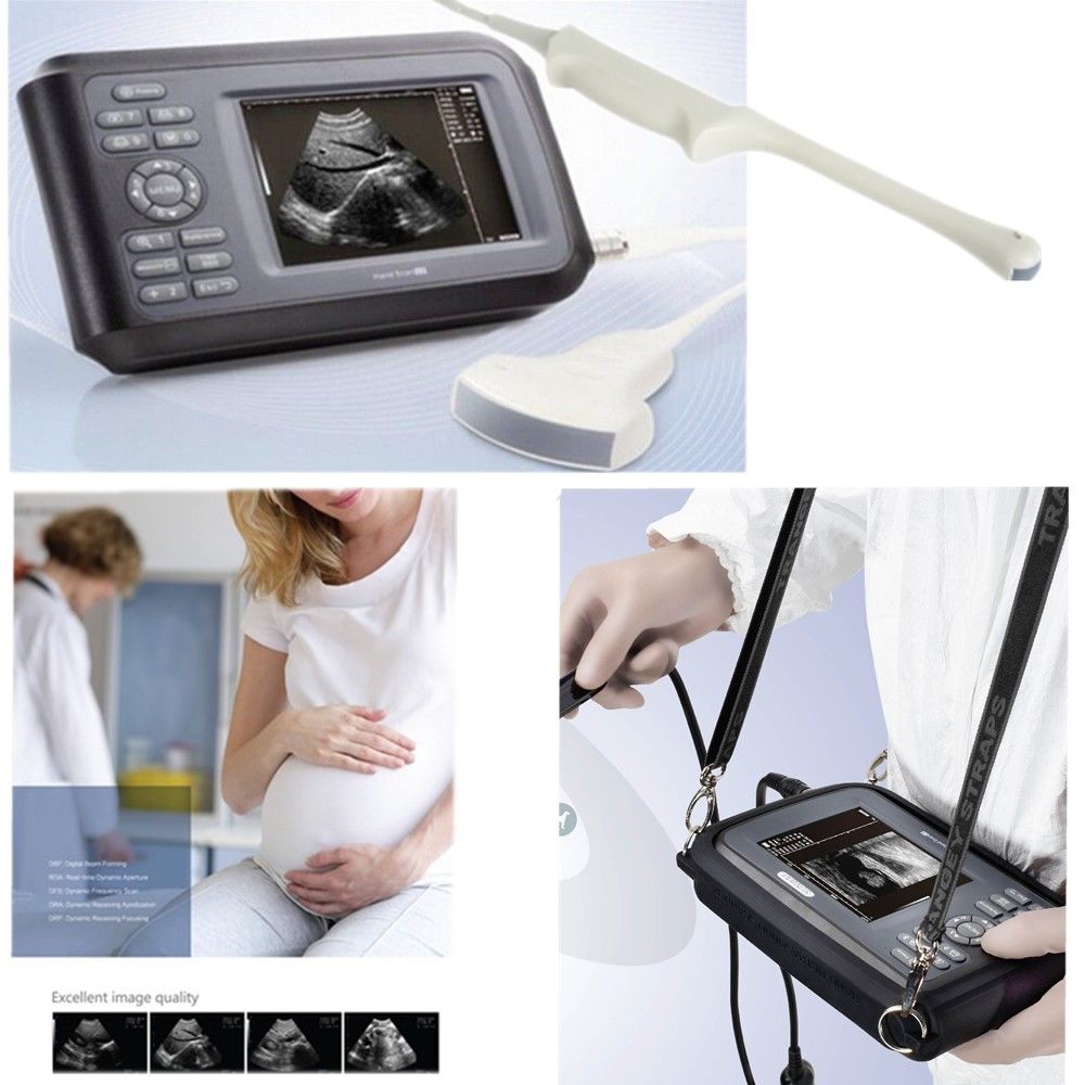 Laptop Machine HandScan Ultrasound scanner Convex + Linear+ Micro convex 3 Probe DIAGNOSTIC ULTRASOUND MACHINES FOR SALE