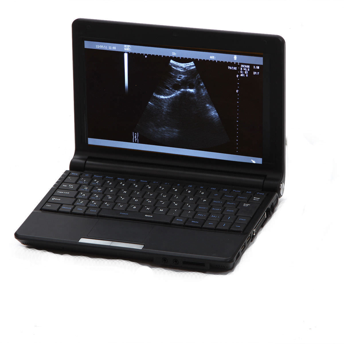 Nootbook Portable Ultrasound Scanner Machine  with Convex probe/Sensor Free 3D 190891915702 DIAGNOSTIC ULTRASOUND MACHINES FOR SALE