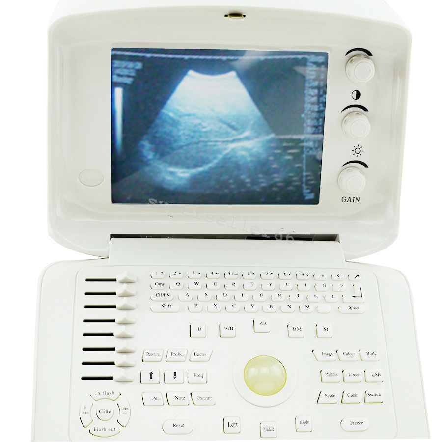 Digital LCD type-B ultrasonic Machine Ultrasound Scanner,Convex,Linear 2 Probes  190891562807 DIAGNOSTIC ULTRASOUND MACHINES FOR SALE