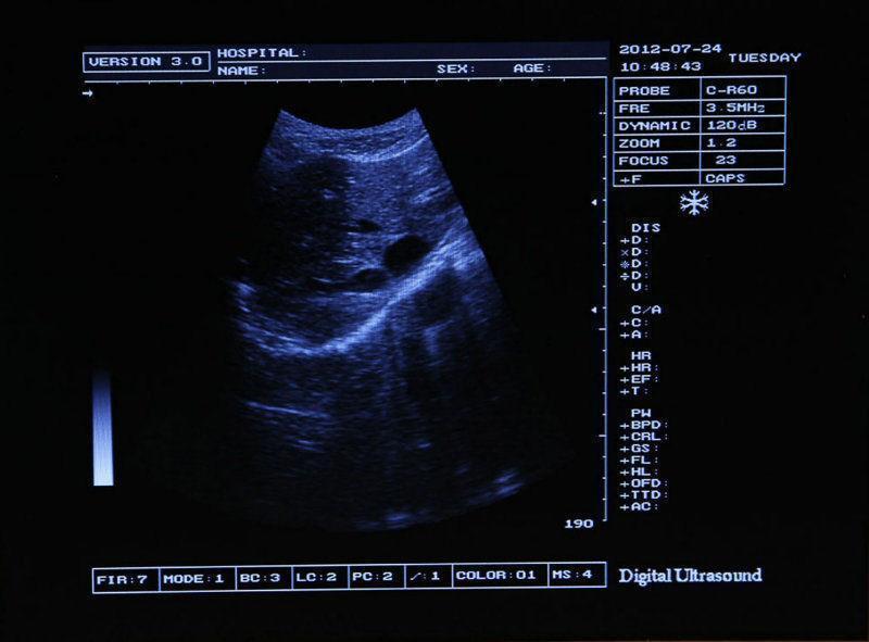 Portable Ultrasound Scanner System Convex  Linear 2 Probes  2 CONNECTORS 3D DIAGNOSTIC ULTRASOUND MACHINES FOR SALE
