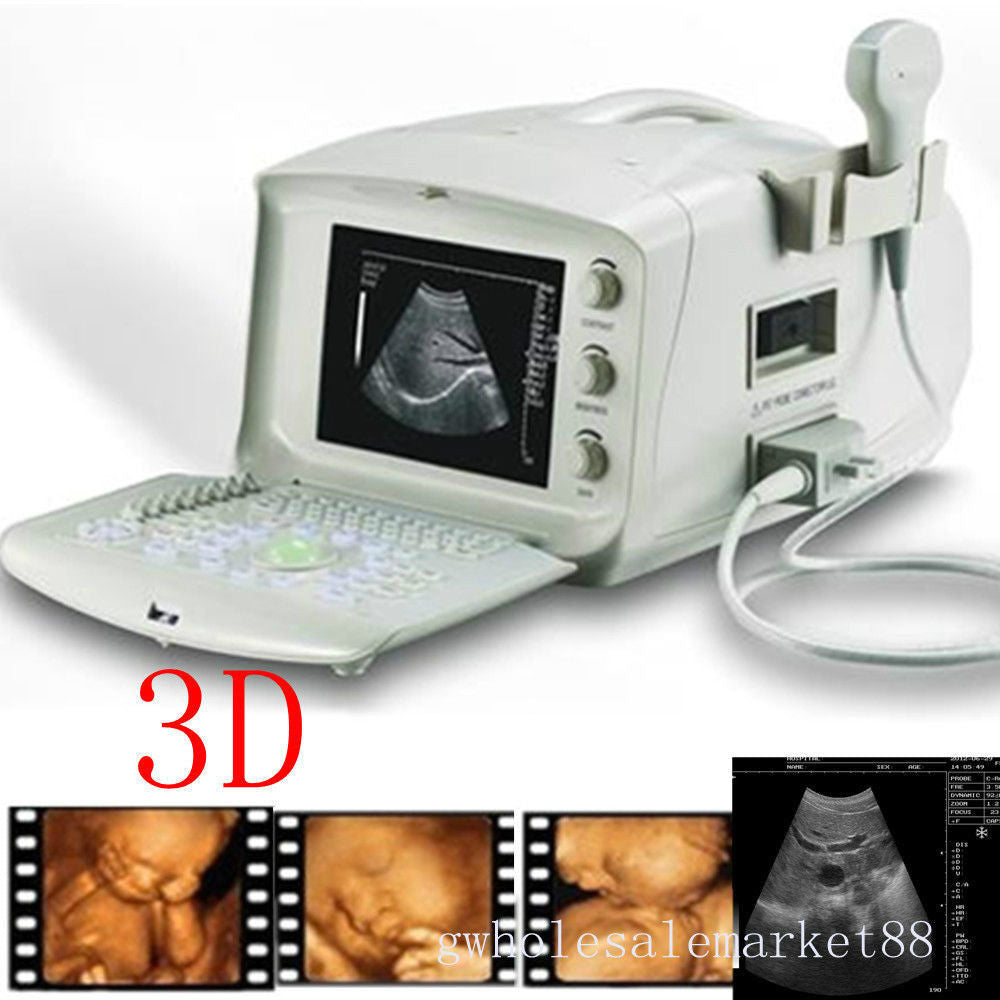 Portable Machine Digital Ultrasound Scanner System + Transvaginal Probe -EXT 3D 190891892607 DIAGNOSTIC ULTRASOUND MACHINES FOR SALE