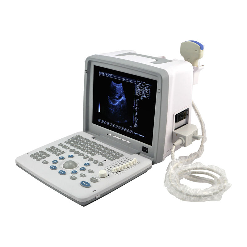 portable B Ultrasound Machine/Scanner Convex Probe ,Optional linear ,vaginal 3D 190891457189 DIAGNOSTIC ULTRASOUND MACHINES FOR SALE