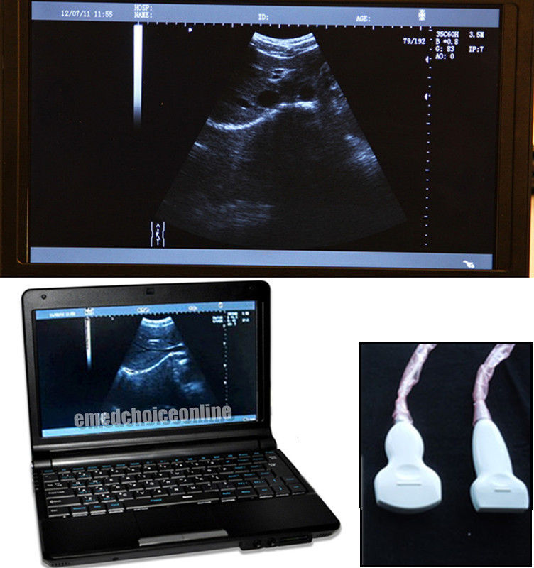 Full Digital Laptop Ultrasound Scanner Covex + Linear 2 Probes 9000F Sale CE 190891787651 DIAGNOSTIC ULTRASOUND MACHINES FOR SALE