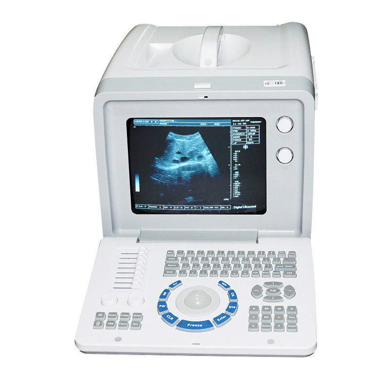 Diagnostic Ultrasound Scanner Machine Convex +Transvaginal 2 Probe 3D Pregnancy 190891422446 DIAGNOSTIC ULTRASOUND MACHINES FOR SALE