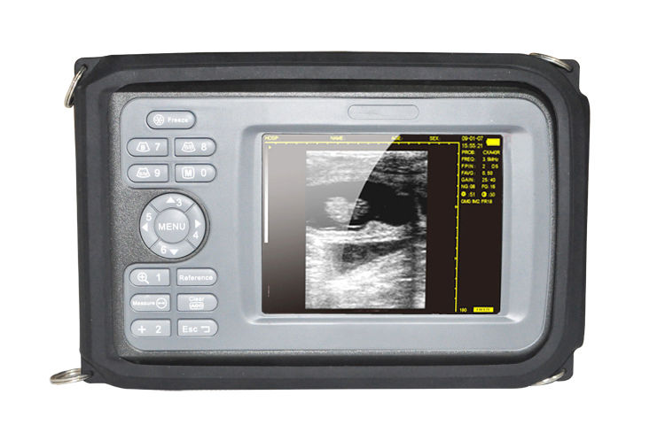Digital LCD Smartscan Machine Ultrasound Scanner & Micro-convex Probe & Battery 190891411631 DIAGNOSTIC ULTRASOUND MACHINES FOR SALE