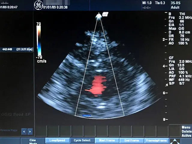 GE LOGIQ BOOK XP  ULTRASOUND WITH  3-PROBE DIAGNOSTIC ULTRASOUND MACHINES FOR SALE