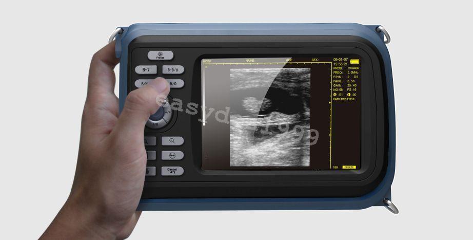 Portable Handheld Digital Ultrasound Scanner Convex Linear Transvaginal 3 Probes 190891305763 DIAGNOSTIC ULTRASOUND MACHINES FOR SALE