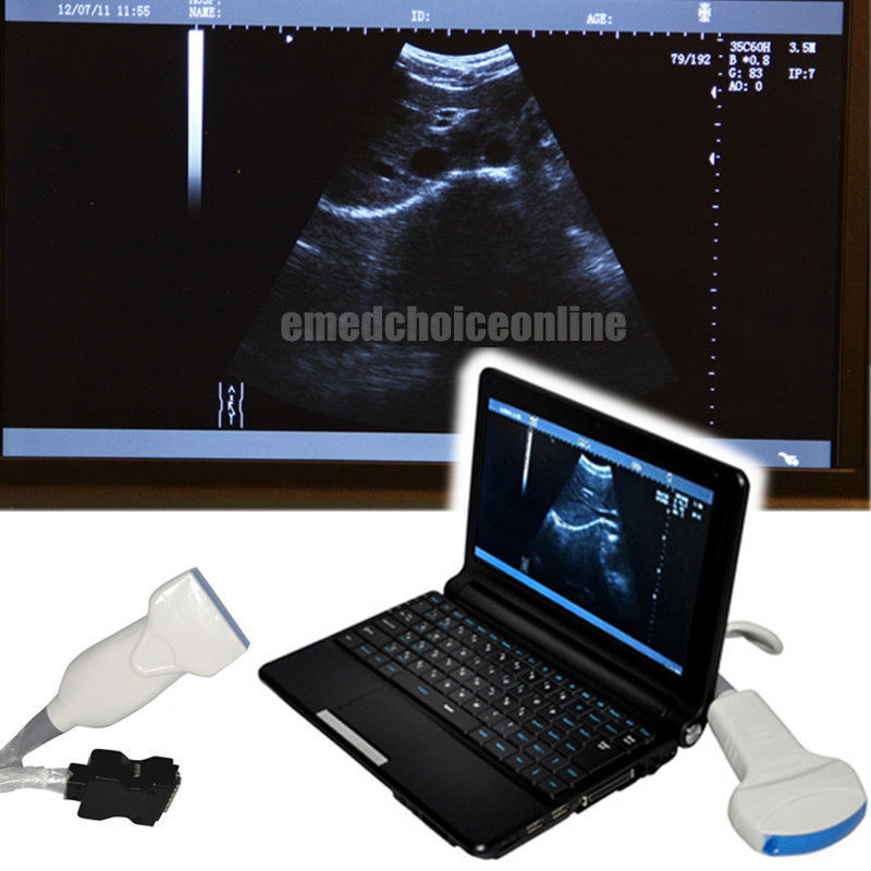 Full Digital Laptop Ultrasound Scanner Linear 9000F + Free 3D Linear probe DHL! DIAGNOSTIC ULTRASOUND MACHINES FOR SALE