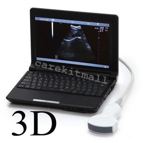 Laptop LCD Ultrasound Scanner Machine +Convex Linear Probe+Sony UP-897MD Printer 190891494573 DIAGNOSTIC ULTRASOUND MACHINES FOR SALE