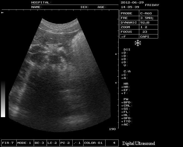 Medical Ultrasonic Machine Ultrasound Scanner Linear Probe/Sensor 3D Software AA 190891665829 DIAGNOSTIC ULTRASOUND MACHINES FOR SALE