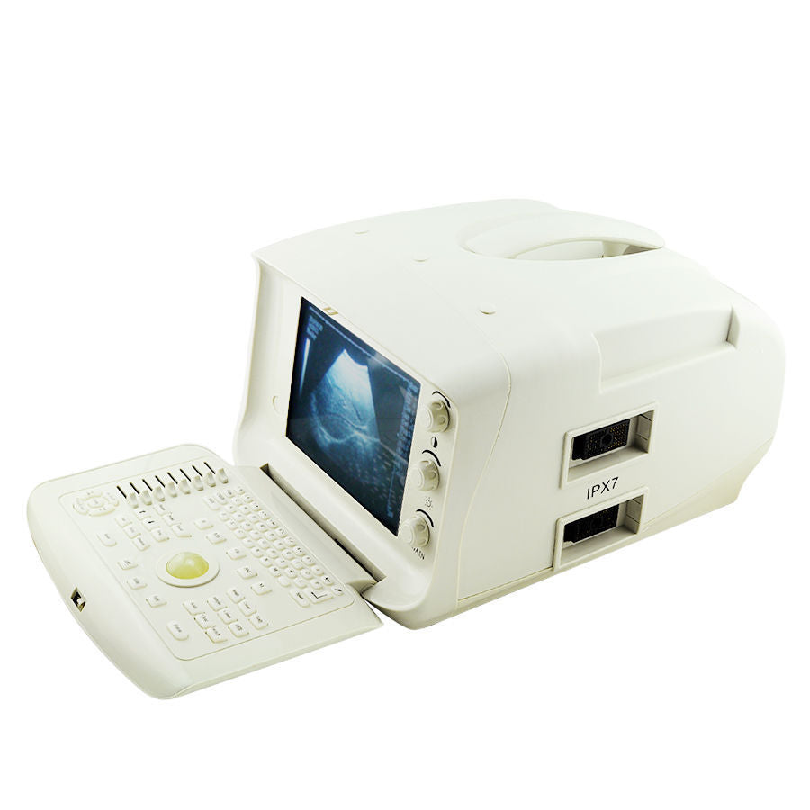 Digital Ultrasound Scanner/Machine 3.5Mhz Convex Transducer/Probe 3D A+ DIAGNOSTIC ULTRASOUND MACHINES FOR SALE