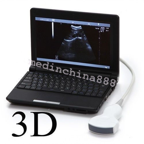 Laptop Ultrasound Scanner +Convex+Linear+Transvaginal 3 Probes Monitor Machine 190891247346 DIAGNOSTIC ULTRASOUND MACHINES FOR SALE