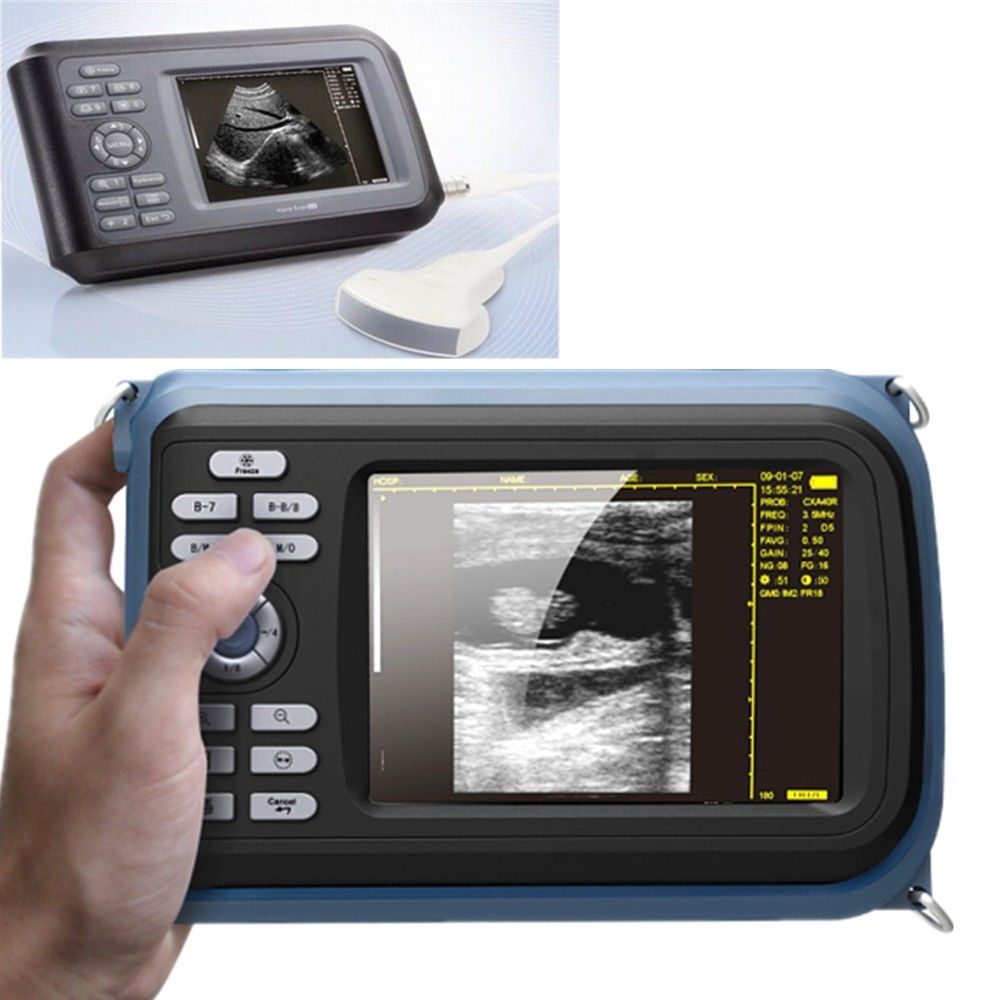 Human Laptop Machine Ultrasound Scanner System Convex + Transvaginal Probe+ Case DIAGNOSTIC ULTRASOUND MACHINES FOR SALE