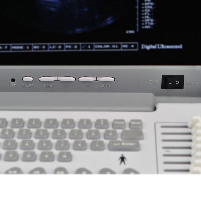 Digital Ultrasound Scanner/Machine Convex + Transvaginal 2 Probe 3D Sale DIAGNOSTIC ULTRASOUND MACHINES FOR SALE