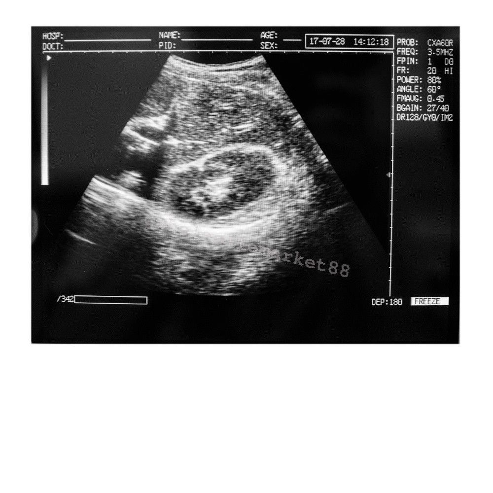 Laptop Ultrasound Machine Scanner Convex Probe 3D Software Clear Medical Clinic 190891045898 DIAGNOSTIC ULTRASOUND MACHINES FOR SALE