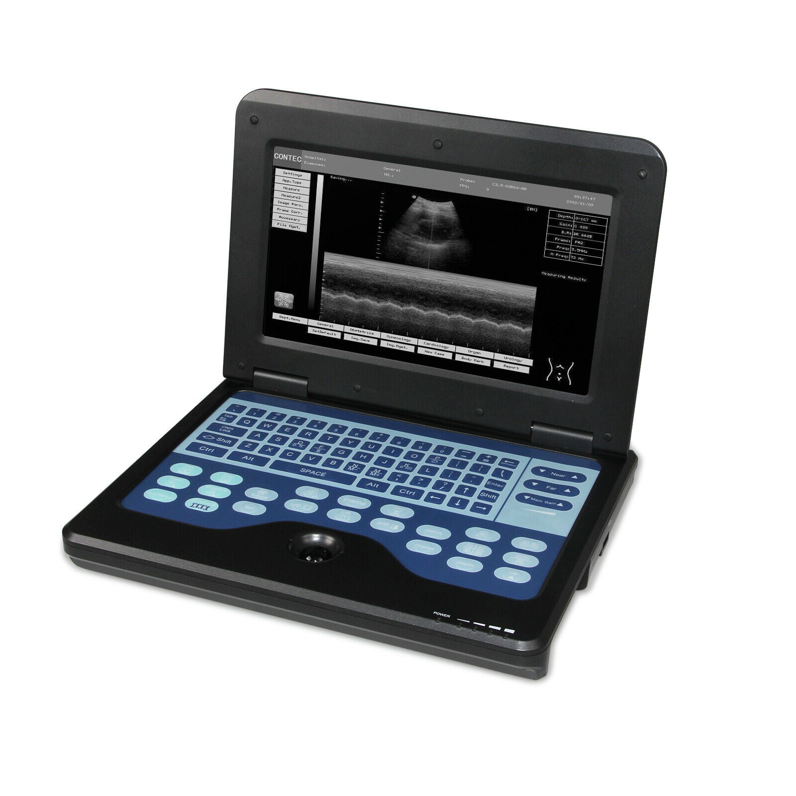 Digital Portable Ultrasound Machine Laptop Scanner with Convex Probe,US shipping 6945040100362 DIAGNOSTIC ULTRASOUND MACHINES FOR SALE