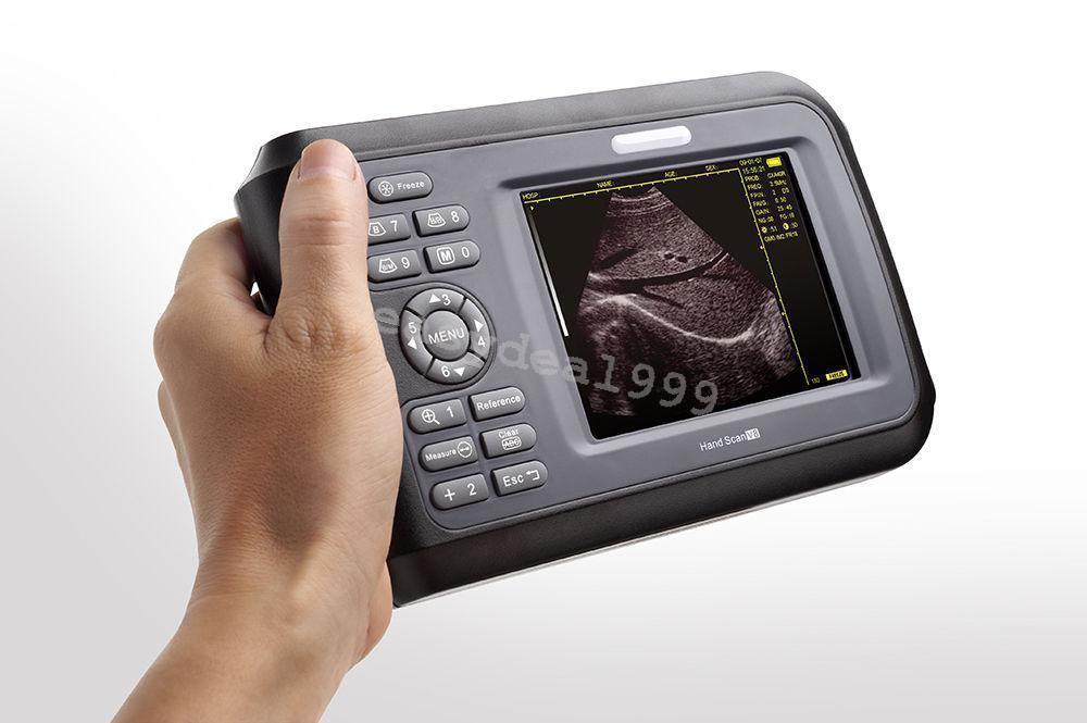 Mini Portable Handheld Digital Ultrasound Scanner Machine +Convex + Linear Probe DIAGNOSTIC ULTRASOUND MACHINES FOR SALE