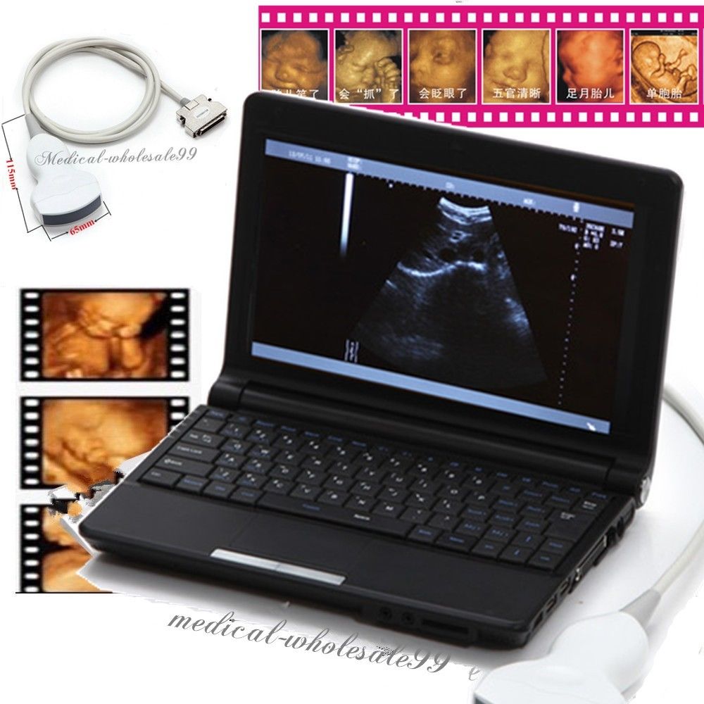 Free 3D Laptop Ultrasonic Ultrasound Scanner Convex & Linear 2 Probes Sale 190891435422 DIAGNOSTIC ULTRASOUND MACHINES FOR SALE