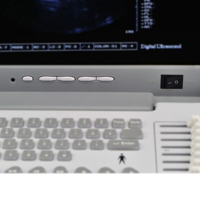 Full Digital Portable LED Ultrasound Scanner abdominal Convex + Linear Probe Set DIAGNOSTIC ULTRASOUND MACHINES FOR SALE