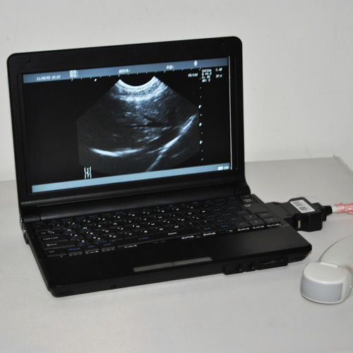 Digital Laptop Notebook Ultrasound Scanner+Convex+Linear+TranVagin Probe 10" LCD DIAGNOSTIC ULTRASOUND MACHINES FOR SALE