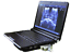 Digital Laptop Ultrasound Scanner/Machine/System convex+micro-convex+3D 2 probes 190891457554 DIAGNOSTIC ULTRASOUND MACHINES FOR SALE