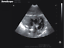 SonoScape A6V Veterinary Ultrasound Scanner Equipment, Probe Choice, Best Deal DIAGNOSTIC ULTRASOUND MACHINES FOR SALE